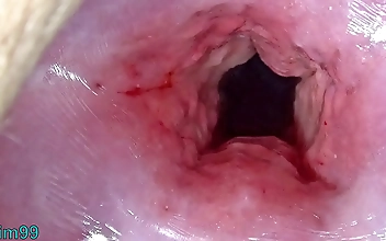 Uncensored Japanese Cervix Stretching and Uterus Dilation with Penetration